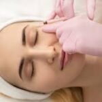 Profhilo Treatment Safety, Recovery & Aftercare Essentials