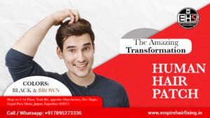 Hair Extension in Jaipur: The Ultimate Solution for Thin or Short Hair
