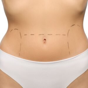 Transform Your Abdomen with the Best Tummy Tuck Surgery for a Sculpted Look