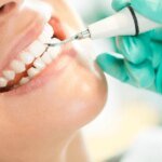 How Teeth Scaling in Islamabad Contributes to Dental Longevity