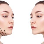 Double Chin Treatment for Photoshoot-Ready Looks in Islamabad