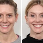 Best Doctors in Dubai for Thread Lift: What Makes Dubai a Beauty Destination