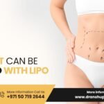 Liposuction Surgery in Dubai – Sculpting Your Ideal Shape with Expert Care by Dr. Anshu