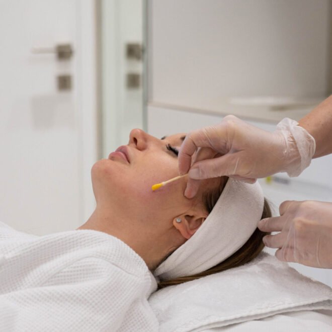 Refresh Your Skin with Chemical Peels – Glamorous Clinic Dubai