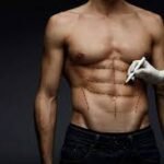 Shape Your Dream Body with Expert Liposuction Surgery in Dubai