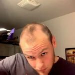 From Thinning to Thriving: Style Hacks for Men With a Receding Hairline