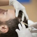 PRP Hair Treatment in Islamabad for Hair Strengthening