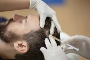 PRP Hair Treatment in Islamabad for Hair Strengthening