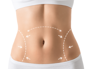 Perfect Abdomen Shape | Modern Cosmetic Solutions Islamabad
