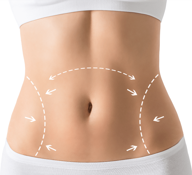 Perfect Abdomen Shape | Modern Cosmetic Solutions Islamabad