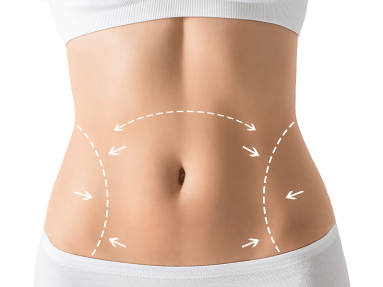 Perfect Abdomen Shape | Modern Cosmetic Solutions Islamabad