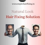 Bald No More: The Rise of Modern Hair Replacement