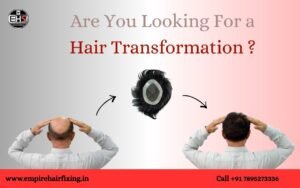 Hair Patch Benefits: How It Helps Balding Men