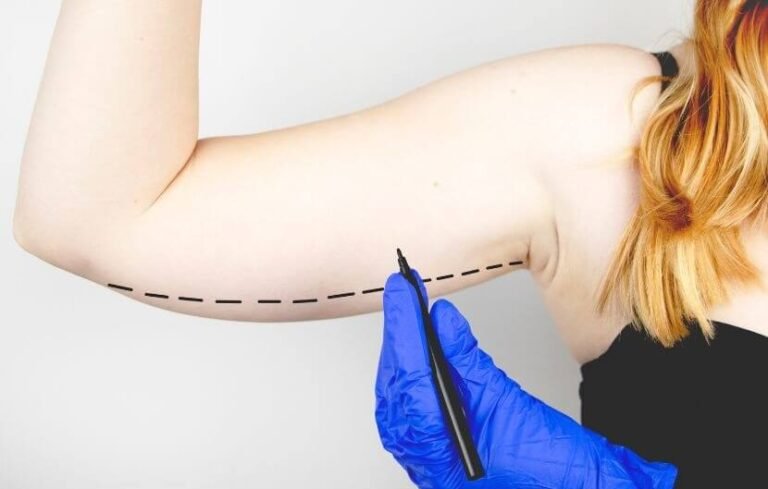 The “Shrink-Wrap” Effect: Firming Up with Arm Lift Surgery in Riyadh