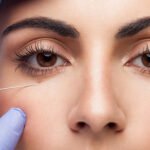 Personalized Dark Circles Treatment in Dubai & Abu Dhabi | Glamorous Clinic Dubai