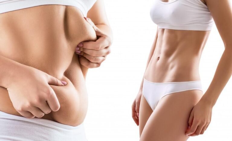 Best Liposuction Surgeon in Dubai Known for Artistic Precision