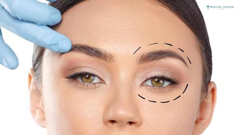 Blepharoplasty in Islamabad to Enhance Eye Shape