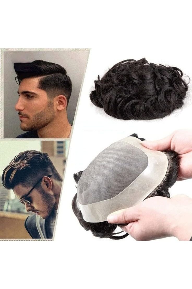 Hair Replacement Systems: How They Work