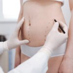 نصائح ذهبية لفترة نقاهة سريعة بعد شفط الدهون في الرياض