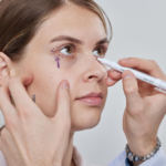 A Complete Guide to Polynucleotides Under Eyes in Manchester