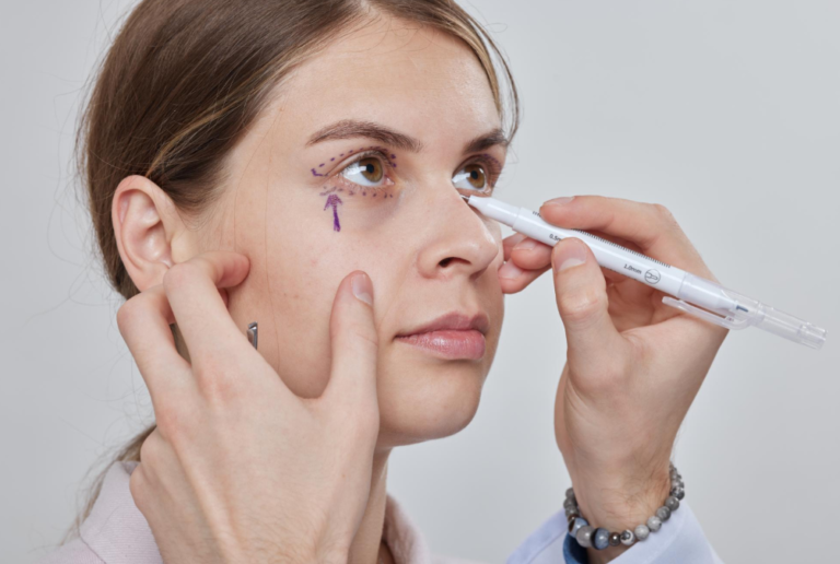 A Complete Guide to Polynucleotides Under Eyes in Manchester