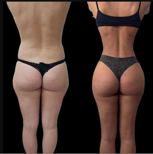 Best Doctors in Dubai Offering J-Plasma for Youthful Skin Restoration