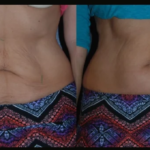 Best Doctors in Dubai Delivering Next-Level Skin Tightening