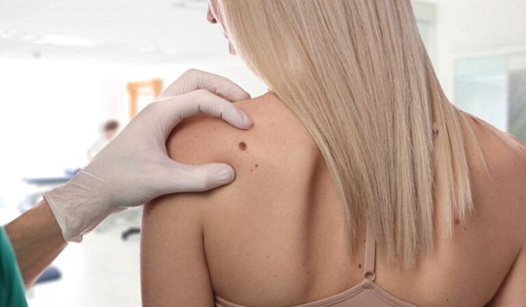 Effective Genital & Skin Warts Removal in Dubai & Abu Dhabi | Glamorous Clinic Dubai