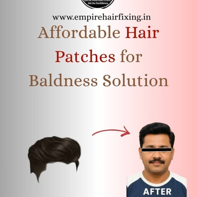 Styling Tips for Hair Patch Wearers: Look Natural and Confident