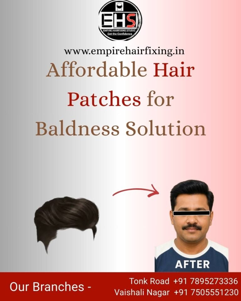 Styling Tips for Hair Patch Wearers: Look Natural and Confident