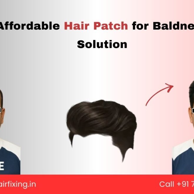 Hair Patch Care Tips: Make It Look Natural & Long-Lasting