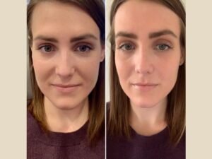 Best Plastic Surgeons in Dubai for PRP Treatment Planning