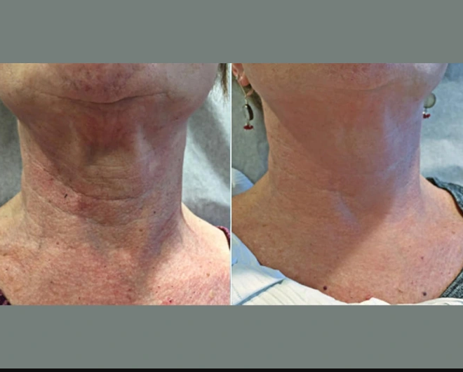 Skin Tightening Treatments in Dubai: A Smart Choice for Skin Health