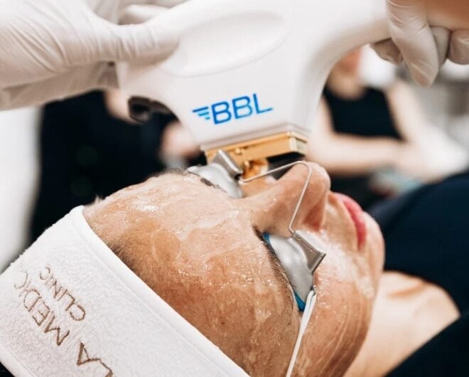 Get Youthful Radiance with BBL Laser in Manchester
