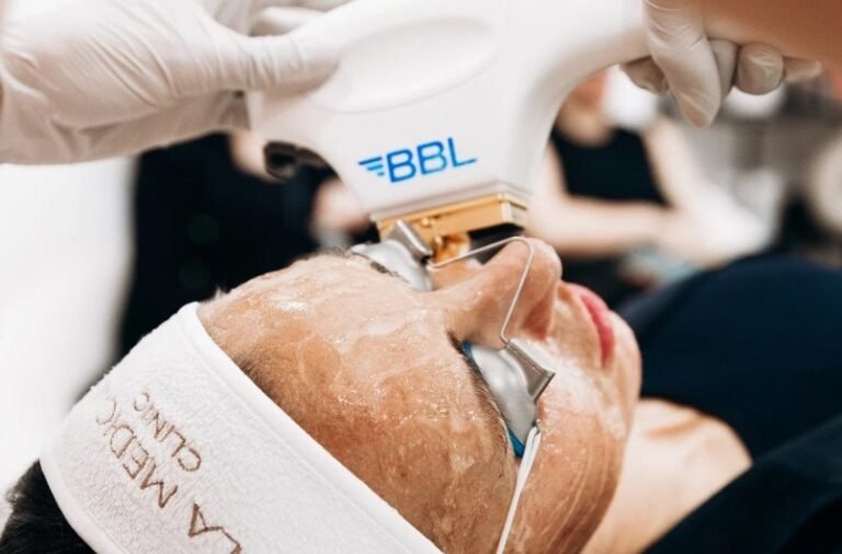 Get Youthful Radiance with BBL Laser in Manchester