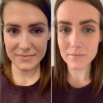 Best Plastic Surgeons in Dubai Delivering Premium PRP Treatment Care