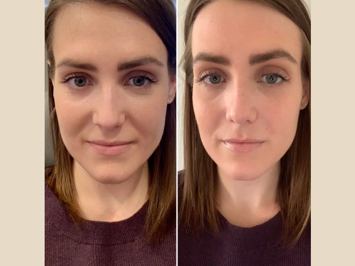 Best Plastic Surgeons in Dubai Delivering Premium PRP Treatment Care