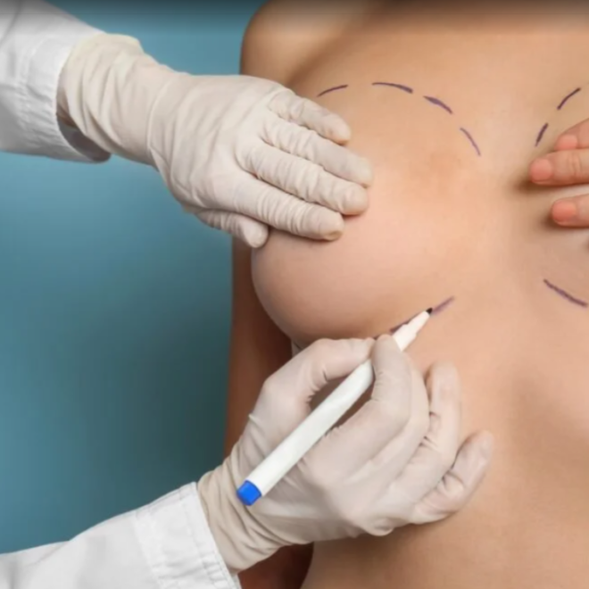 MIA Breast Implant in Dubai – Advanced Medical Technology