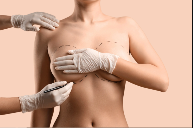 Breast Augmentation In Dubai