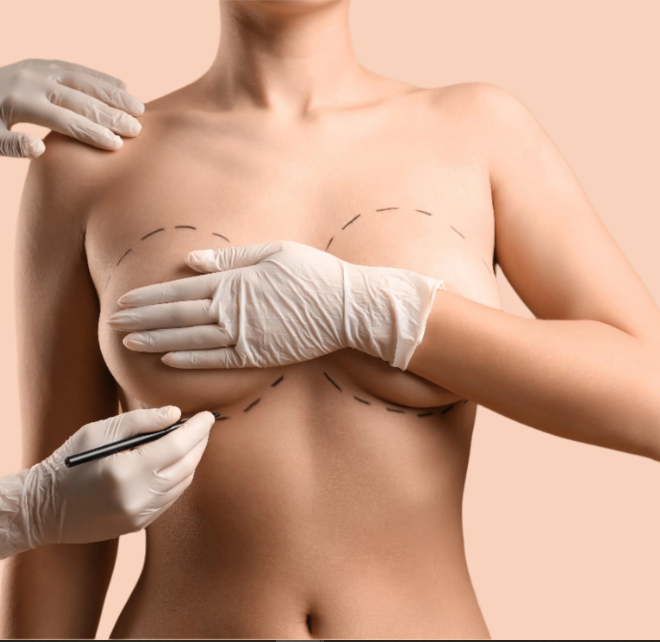 Breast Augmentation In Dubai: Modern Breast Enhancement for Elegant Contours
