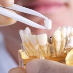 Advanced Dental Aligners in Pune for Discreet Smile Correction