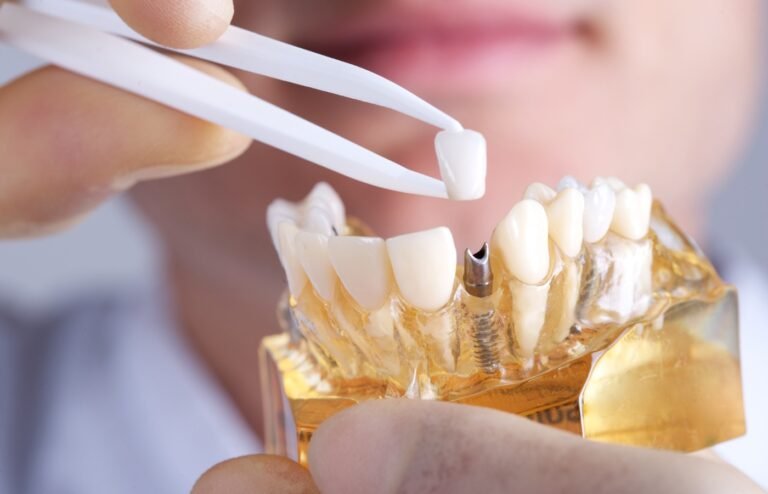 Advanced Dental Aligners in Pune for Discreet Smile Correction